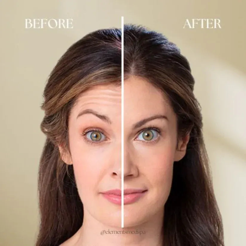 Maax Celimax Retinol Shot Tightening Booster | Advanced Firming & Anti-Aging Serum | Buy 1 Get 1 FREE